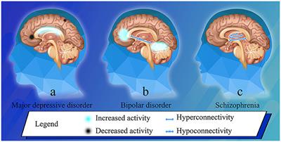 Commentary: Targeting the MRI-mapped psychopathology of major psychiatric disorders with neurostimulation